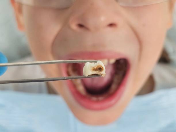 Best Urgent Tooth Repair  in Steiner Ranch, TX